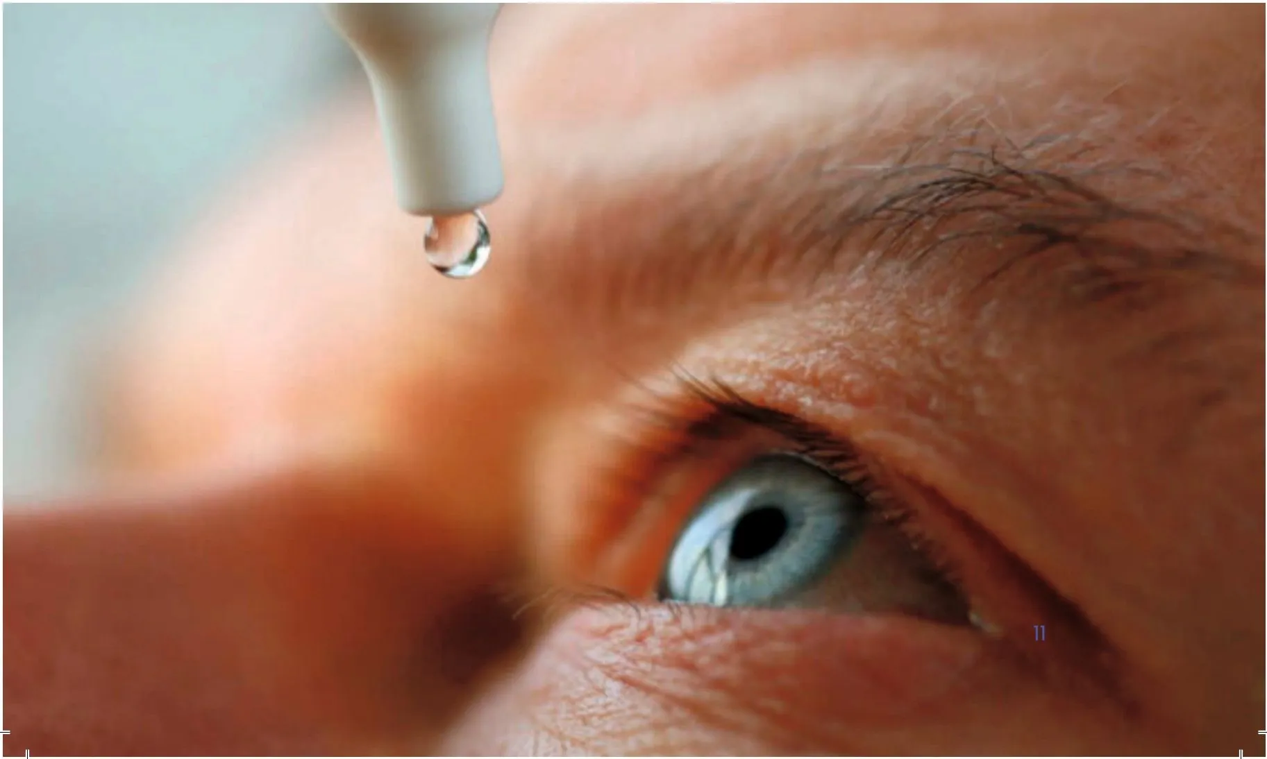 Post-operative eye drops — infection and inflammation prevention