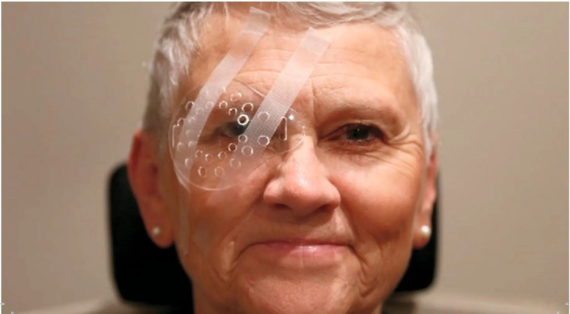 Patient wearing eye shield after cataract surgery