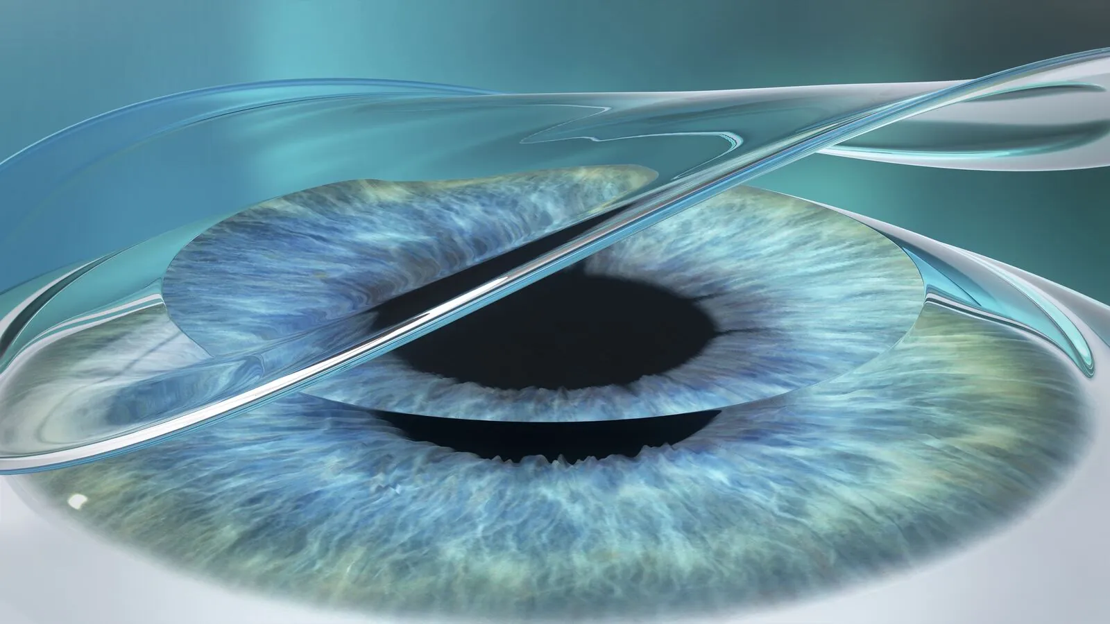 Bandage contact lens is placed on the eye